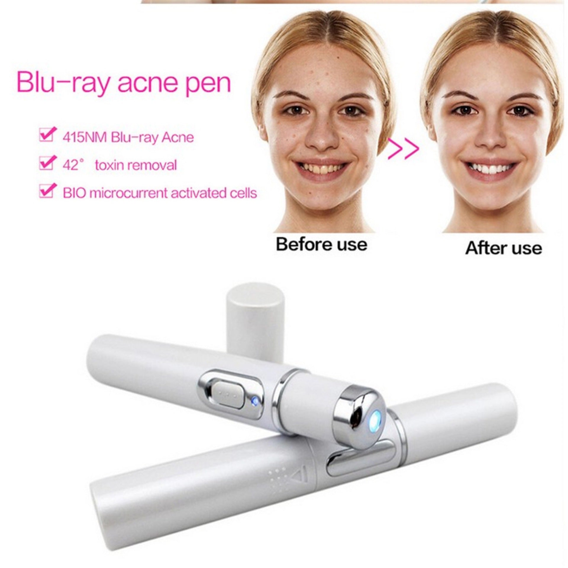ClearPulse Blue™ – Acne & Skin Renewal Therapy Pen