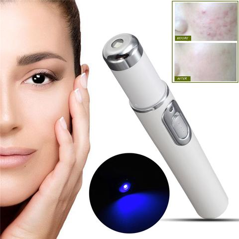 ClearPulse Blue™ – Acne & Skin Renewal Therapy Pen